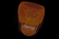 Volumetric Rendering Screenshot
